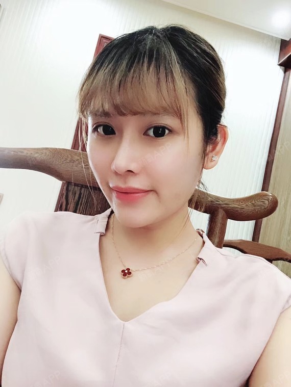 傲视去鼻综合第83天美丽日记-新氧美容整形