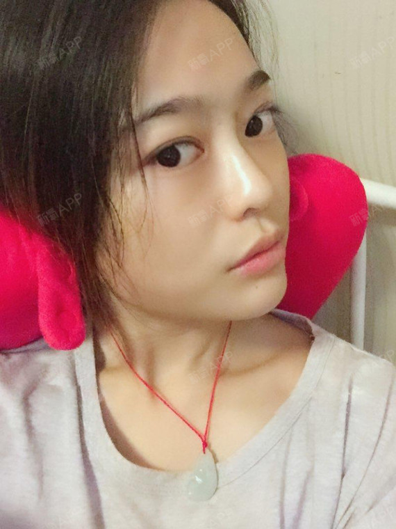 当自强 | 埋线提升 | 北京同城 | 阳泉同城 | 脸颊