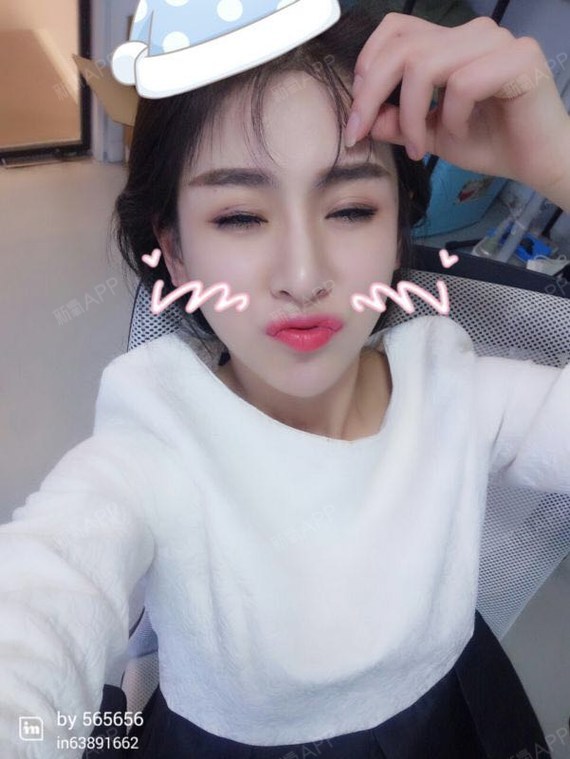 肤白貌美大长腿下一句是自体脂肪全脸填充第1