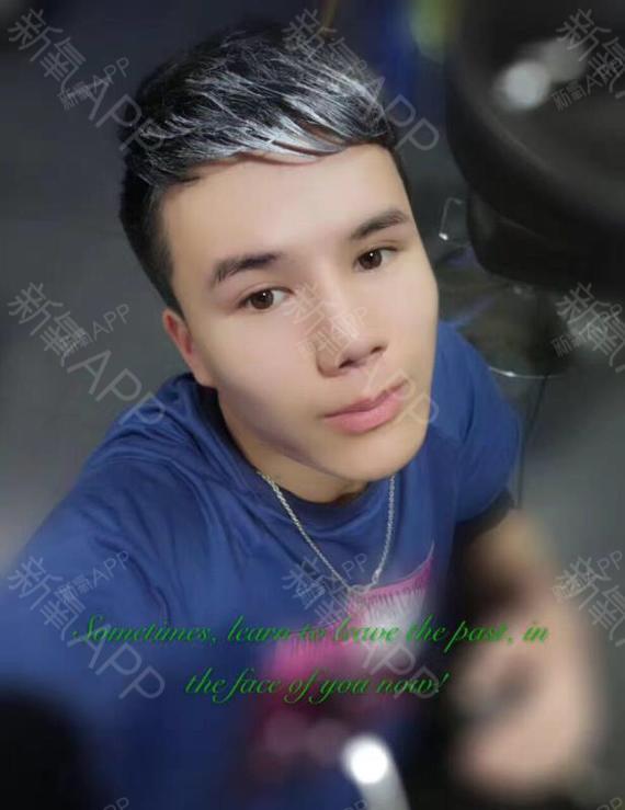 爱情买家i后悔了切开双眼皮第200天美丽日记-