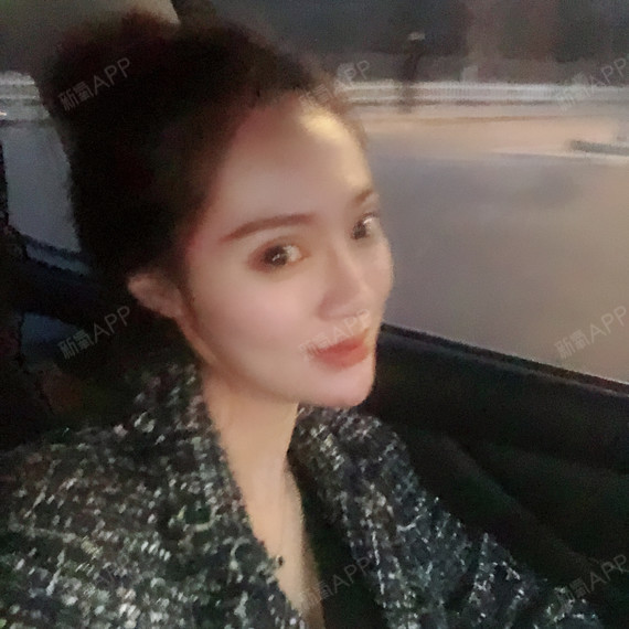 氧气xt7xt埋线提升第45天美丽日记-新氧美容整