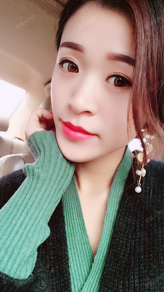 轮廓 | 术后当自强 | 埋线提升 | 北京同城 | 脸颊