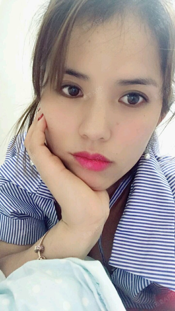 药不能停呀玻尿酸垫下巴第1天美丽日记-新氧美