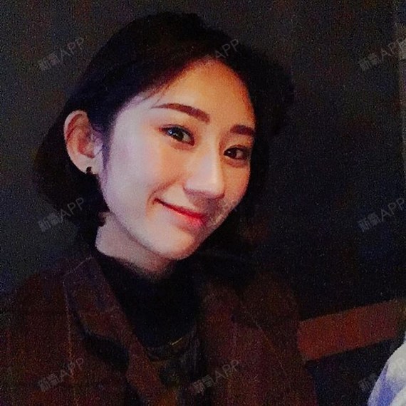 氧气8755321525254513自体脂肪丰苹果肌第3