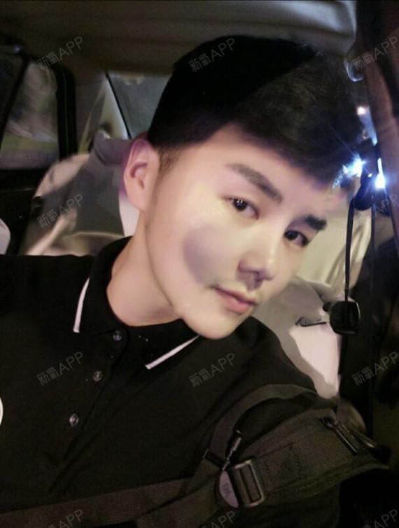 Dylan212肉毒素瘦脸第1天美丽日记-新氧美容整