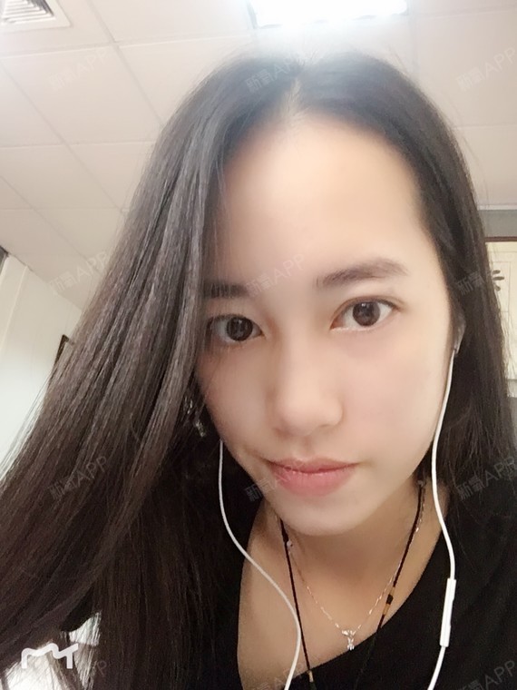 颖宝死忠粉种植发际线第85天美丽日记-新氧美