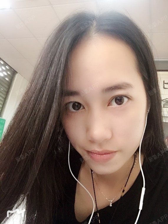 颖宝死忠粉种植发际线第85天美丽日记-新氧美