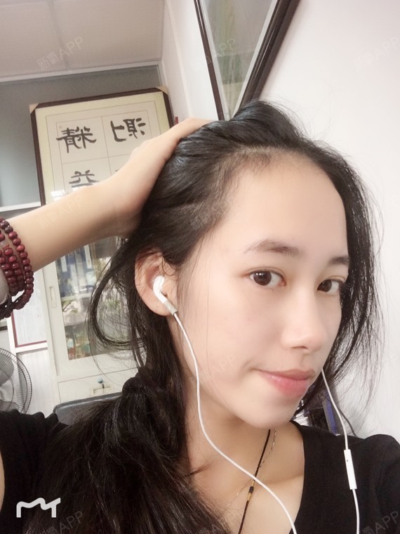 颖宝死忠粉种植发际线第85天美丽日记-新氧美