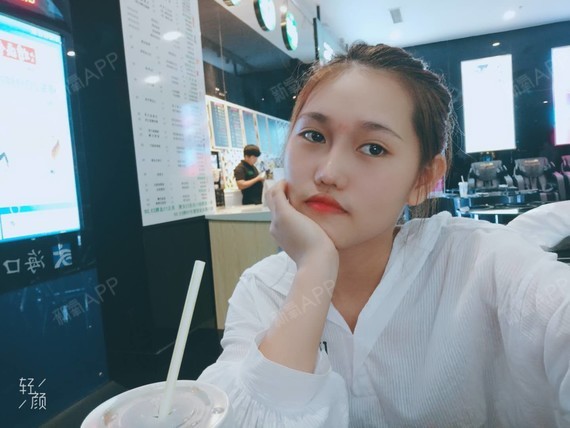 萝卜兔吃菜耳软骨复合隆鼻第64天美丽日记-新