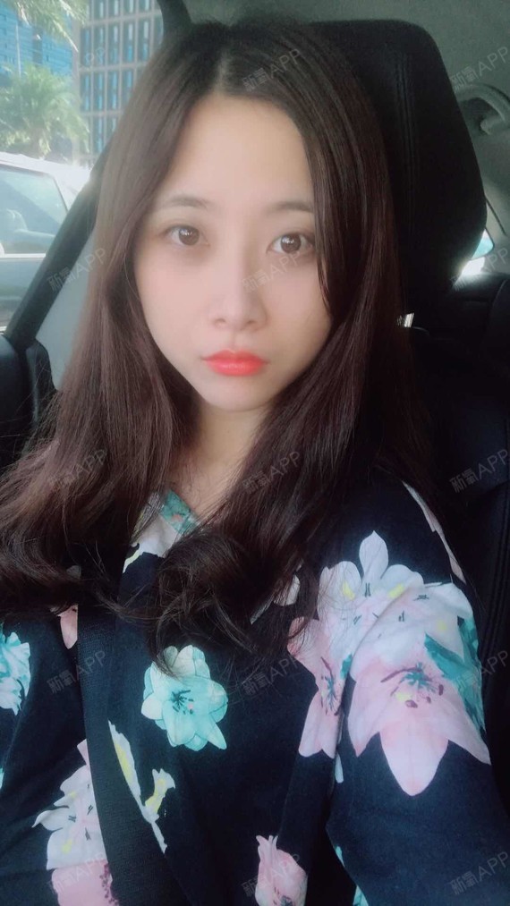 氧气0243701526640714激光去眼袋第158天美