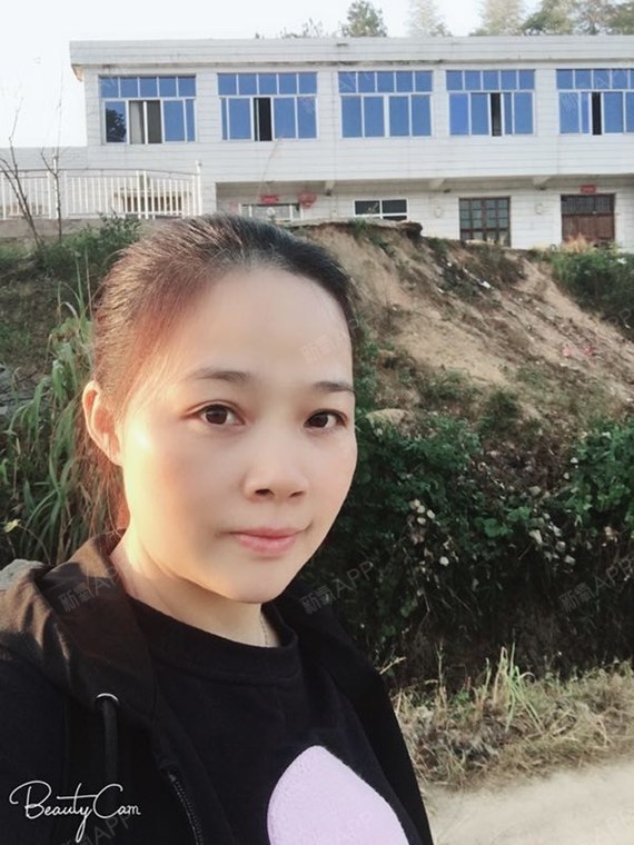 明明是不是我热玛吉第73天美丽日记-新氧美容