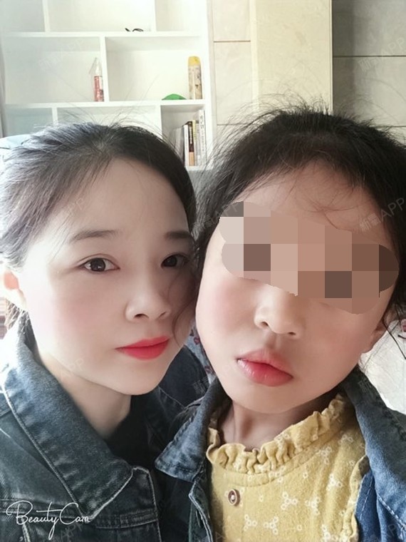 明明是不是我热玛吉第73天美丽日记-新氧美容