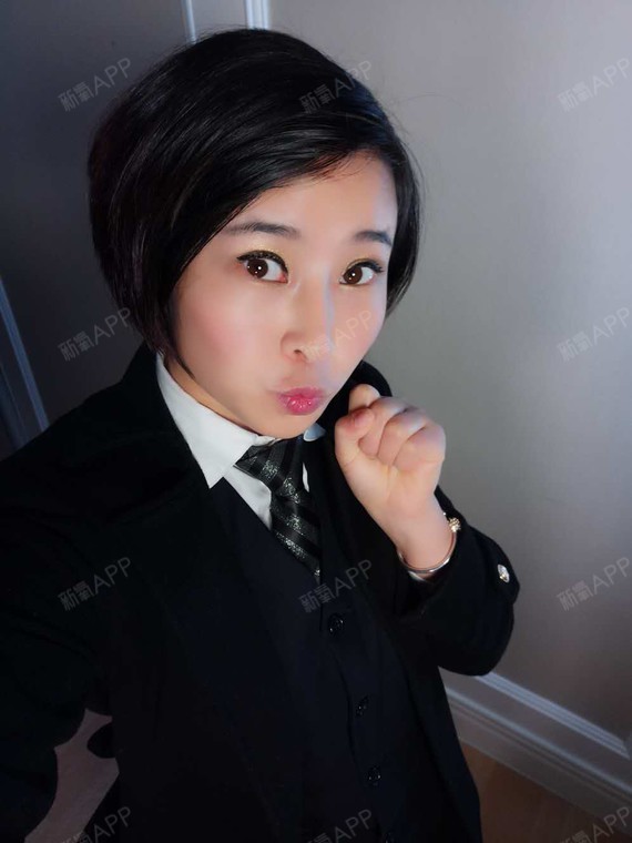 风晴雪人膨体隆鼻第183天美丽日记-新氧美容整