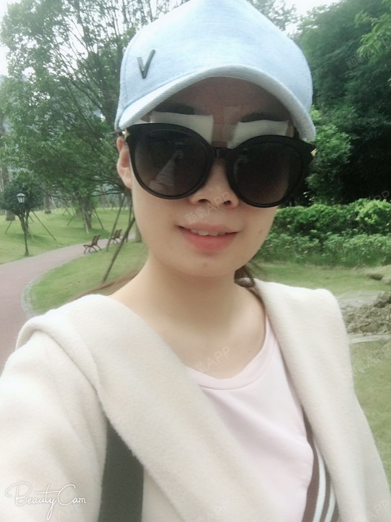 五钾尘世尽眼部综合第0天美丽日记-新氧美容整