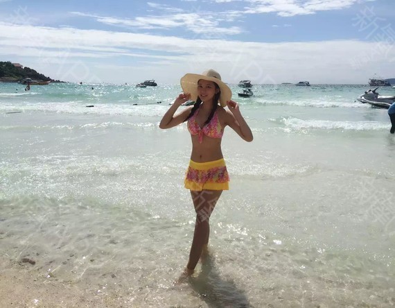 现成饭假体隆胸第215天美丽日记-新氧美容整形