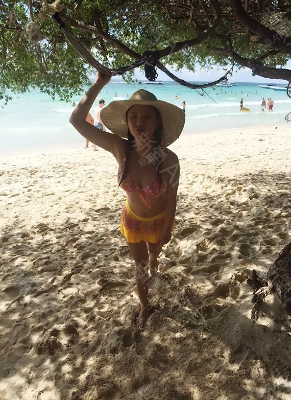 现成饭假体隆胸第215天美丽日记-新氧美容整形