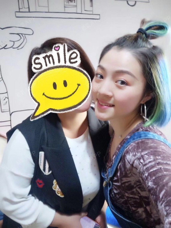 61493004301埋线隆鼻第80天美丽日记-新氧美