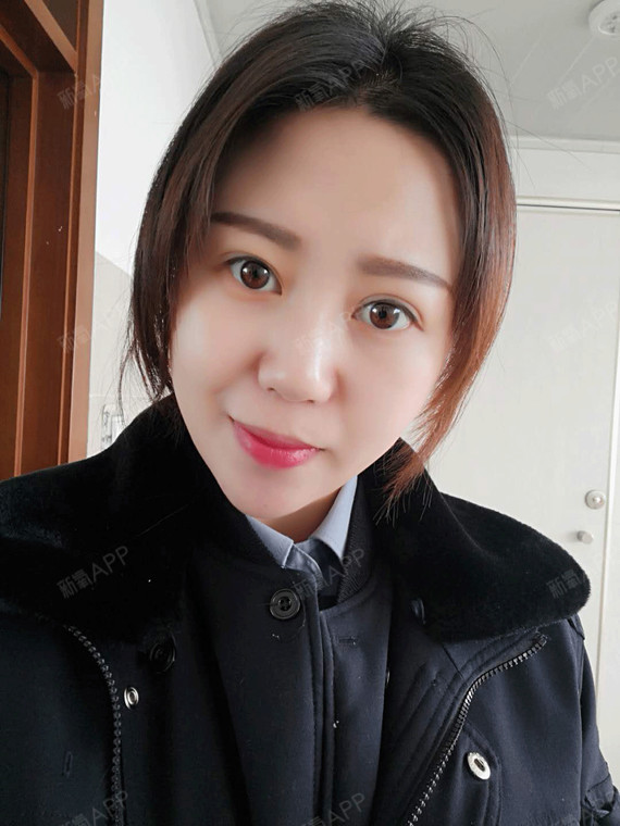 阁楼里的小花面部吸脂第17天美丽日记-新氧美