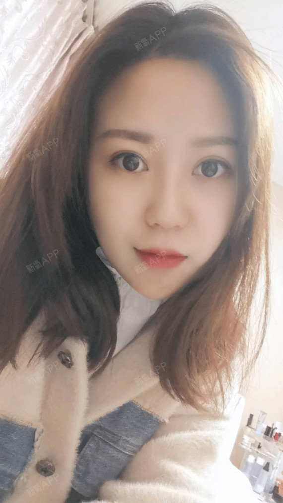 阁楼里的小花面部吸脂第17天美丽日记-新氧美