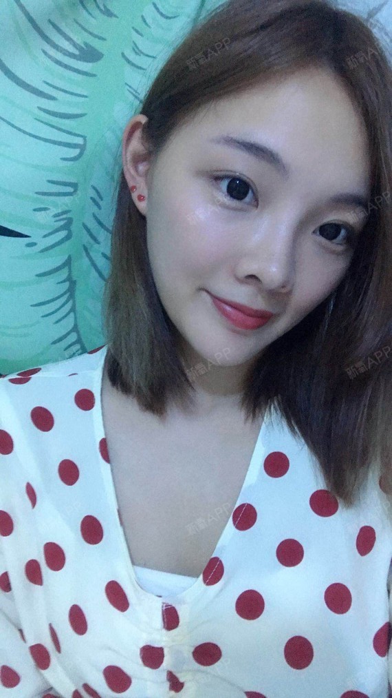 雪宇鼻综合第248天美丽日记-新氧美容整形