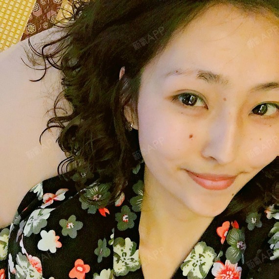 吓一跳鼻综合第3天美丽日记-新氧美容整形