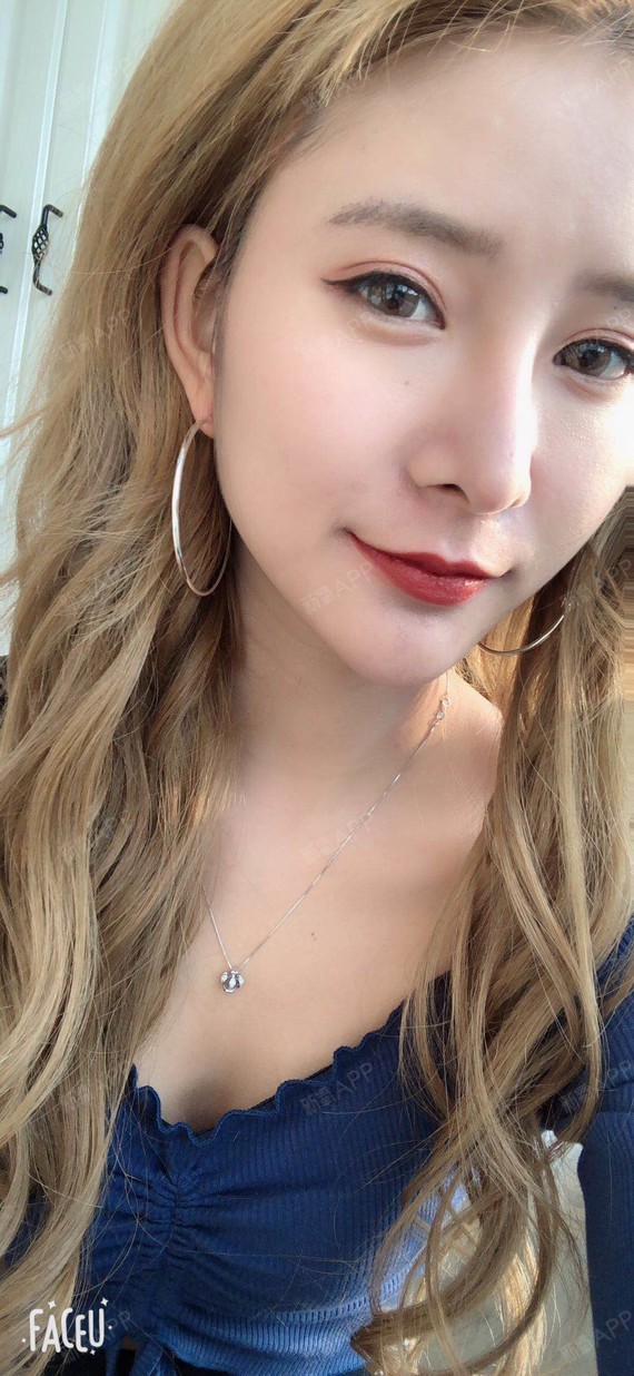 氧气6560921512364713玻尿酸丰面颊第7天美