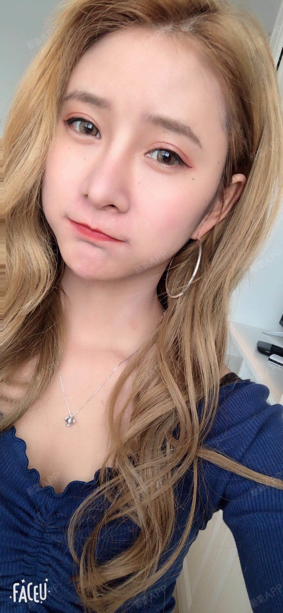 氧气6560921512364713玻尿酸丰面颊第7天美