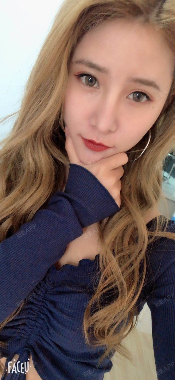 氧气6560921512364713玻尿酸丰面颊第7天美