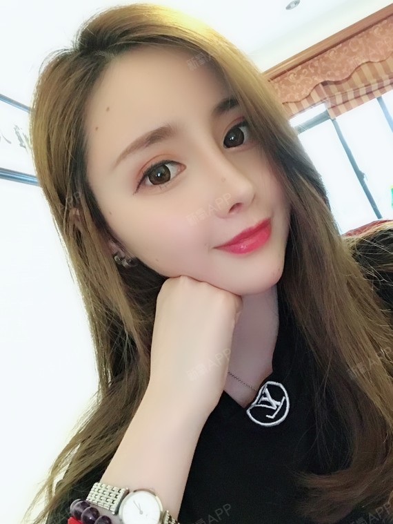 Tian恬恬眼部综合第90天美丽日记-新氧美容整