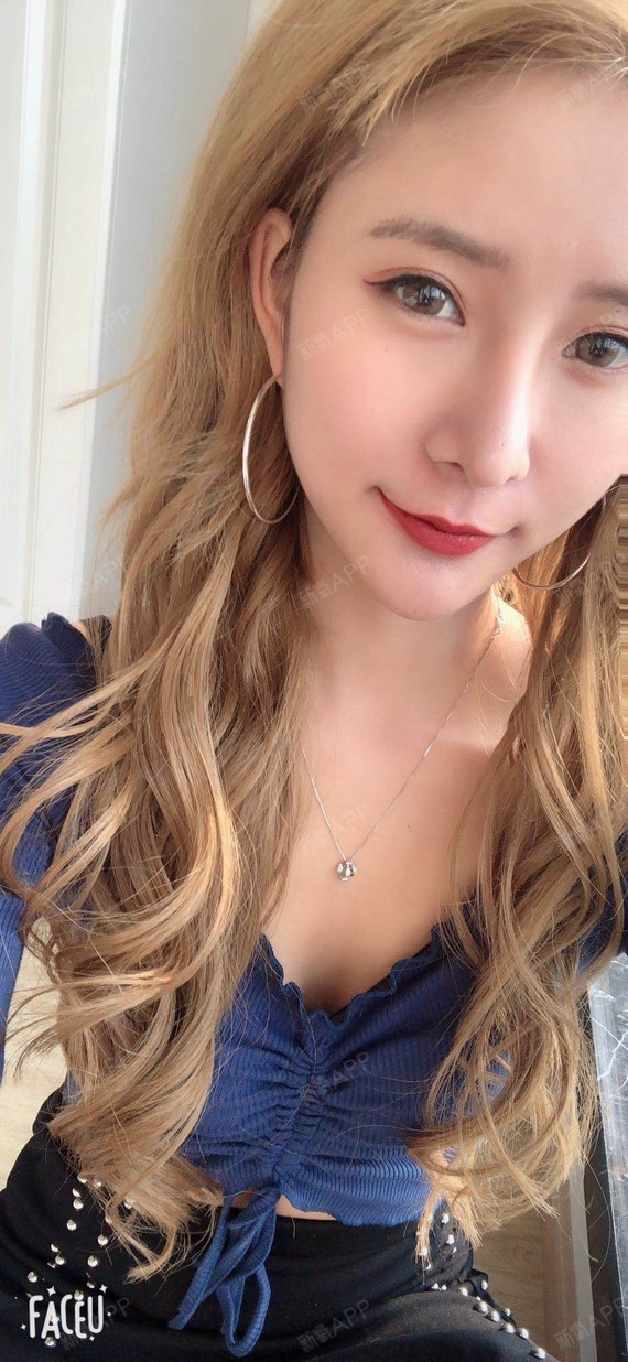 氧气6560921512364713玻尿酸丰面颊第7天美