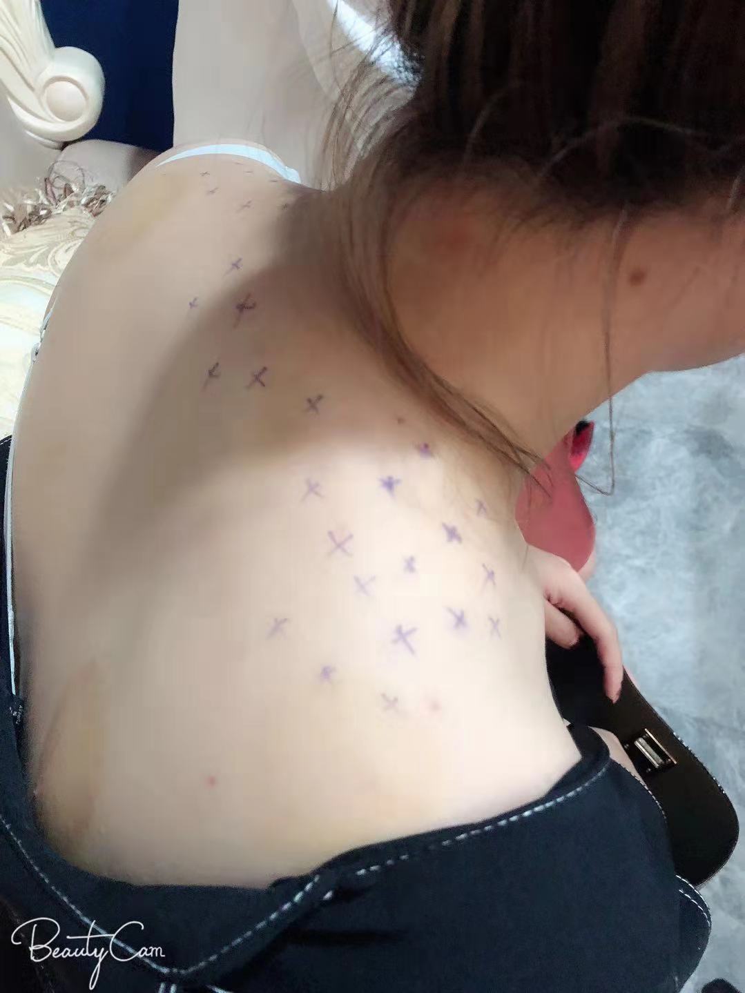 肉毒素瘦肩肌怎么样_冬天的太阳最暖和的美丽日记