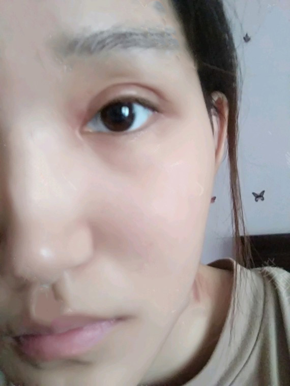 上睑提肌