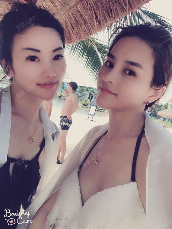 luse肋软骨隆鼻第16天美丽日记-新氧美容整形