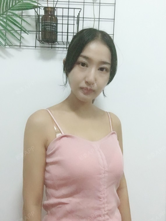 假体隆胸