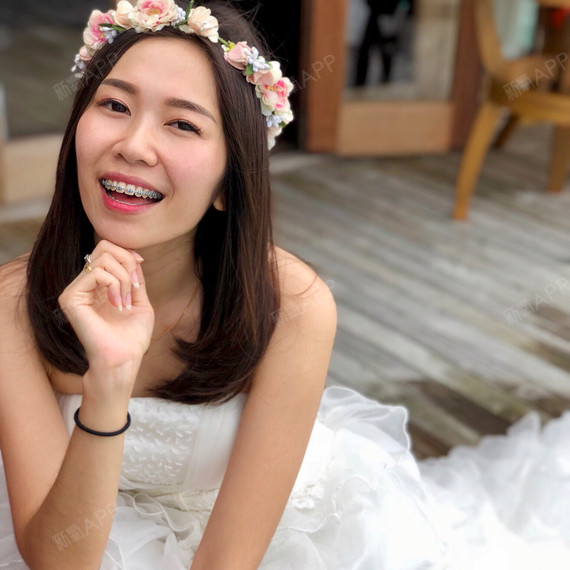 牙套妈妈三个娃金属托槽矫正第550天美丽日记