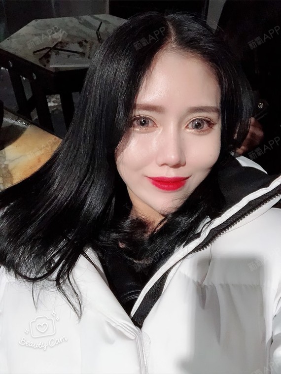 我非南湘为何甜美鼻综合第136天美丽日记-新氧