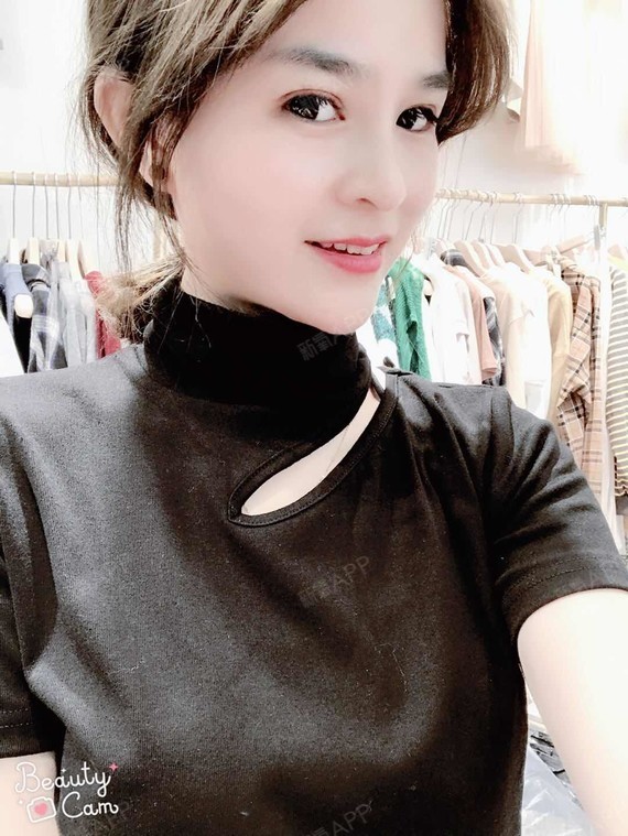 luse肋软骨隆鼻第24天美丽日记-新氧美容整形