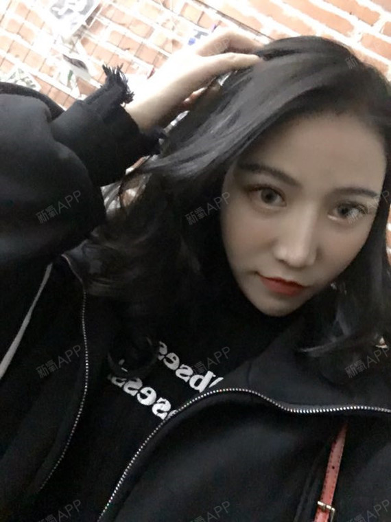 叶非墨虹光纤溶脂瘦脸第78天美丽日记-新氧美