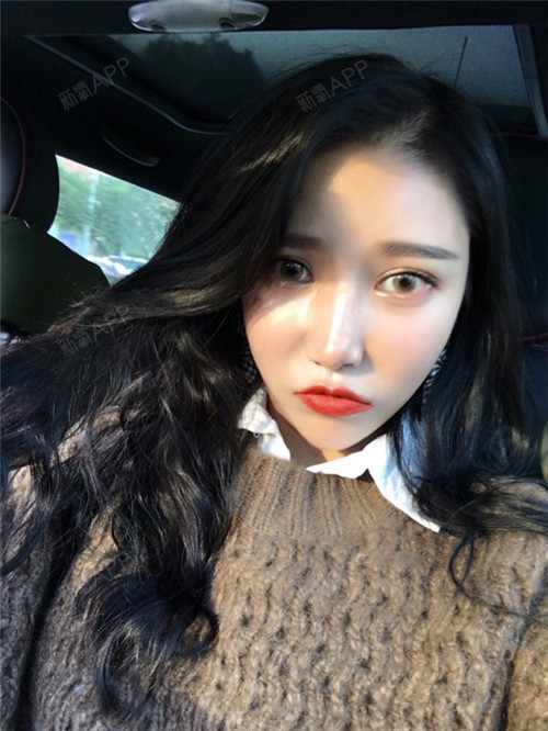 叶非墨虹光纤溶脂瘦脸第78天美丽日记-新氧美