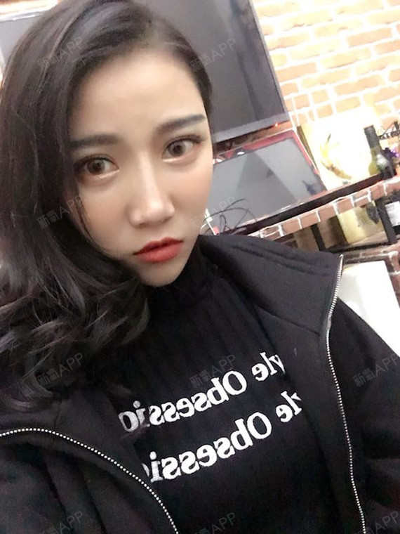 叶非墨虹光纤溶脂瘦脸第78天美丽日记-新氧美