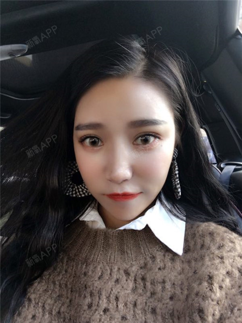 叶非墨虹光纤溶脂瘦脸第78天美丽日记-新氧美