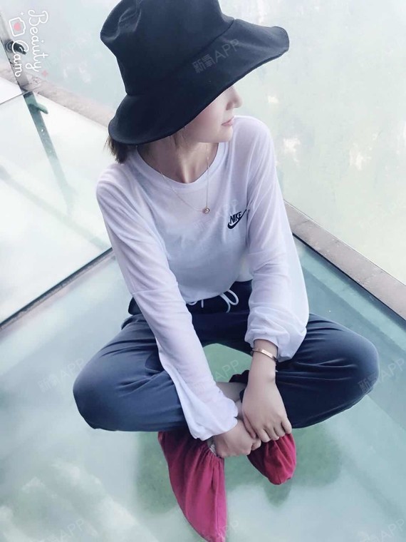 luse肋软骨隆鼻第29天美丽日记-新氧美容整形