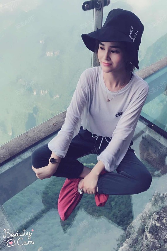 luse肋软骨隆鼻第29天美丽日记-新氧美容整形