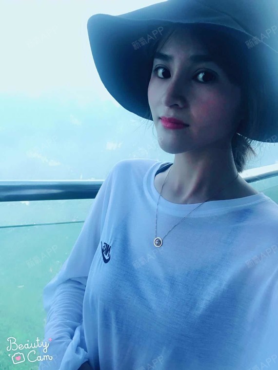 luse肋软骨隆鼻第29天美丽日记-新氧美容整形