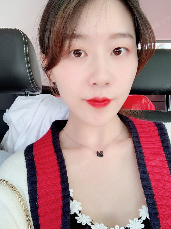 远方9玻尿酸垫下巴第3天美丽日记-新氧美容整