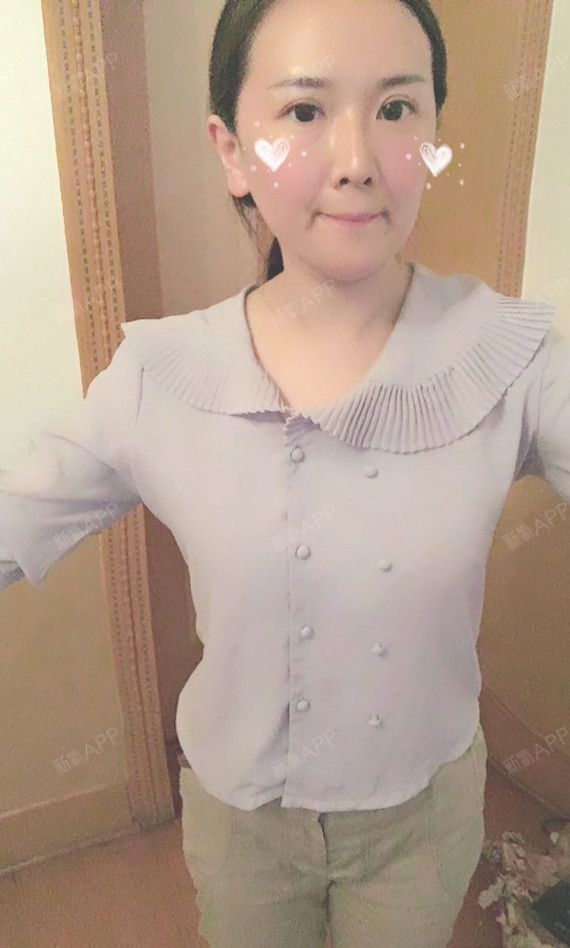 Miss羊羊吸脂瘦腰腹第26天美丽日记-新氧美容