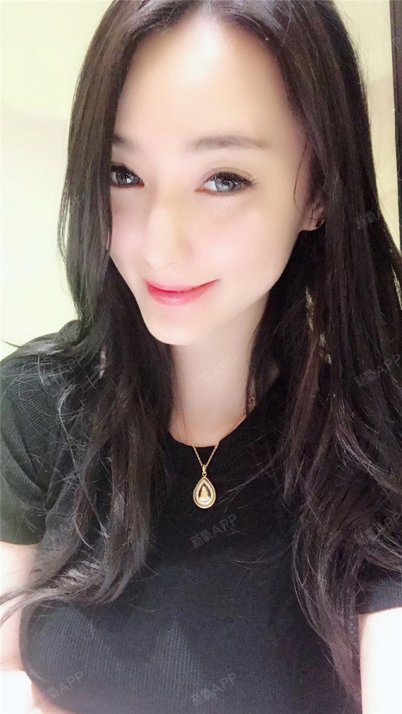 氧气x2neq埋线提升第13天美丽日记-新氧美容