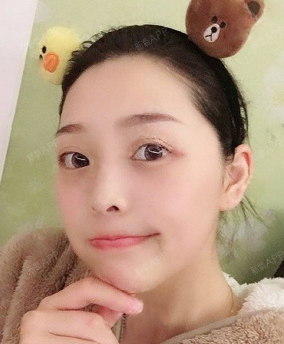 舞蹈_yp23a瘦脸溶脂丽日第7天美方法记相机瘦肚子的最快光纤图片