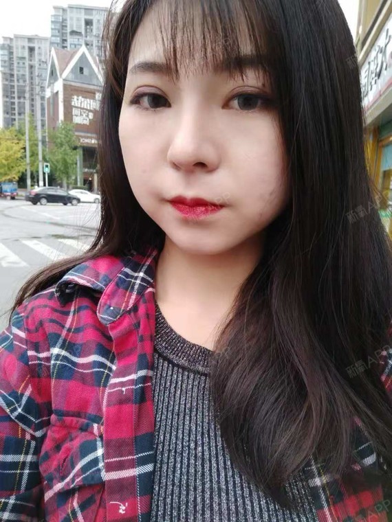 茜茜公举美丽日记-新氧美容整形