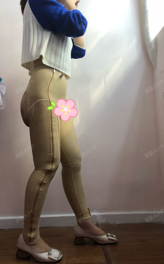 新氧- 氧气3567641522937901 | 美体塑形 | 自体脂肪丰臀 | 术后当